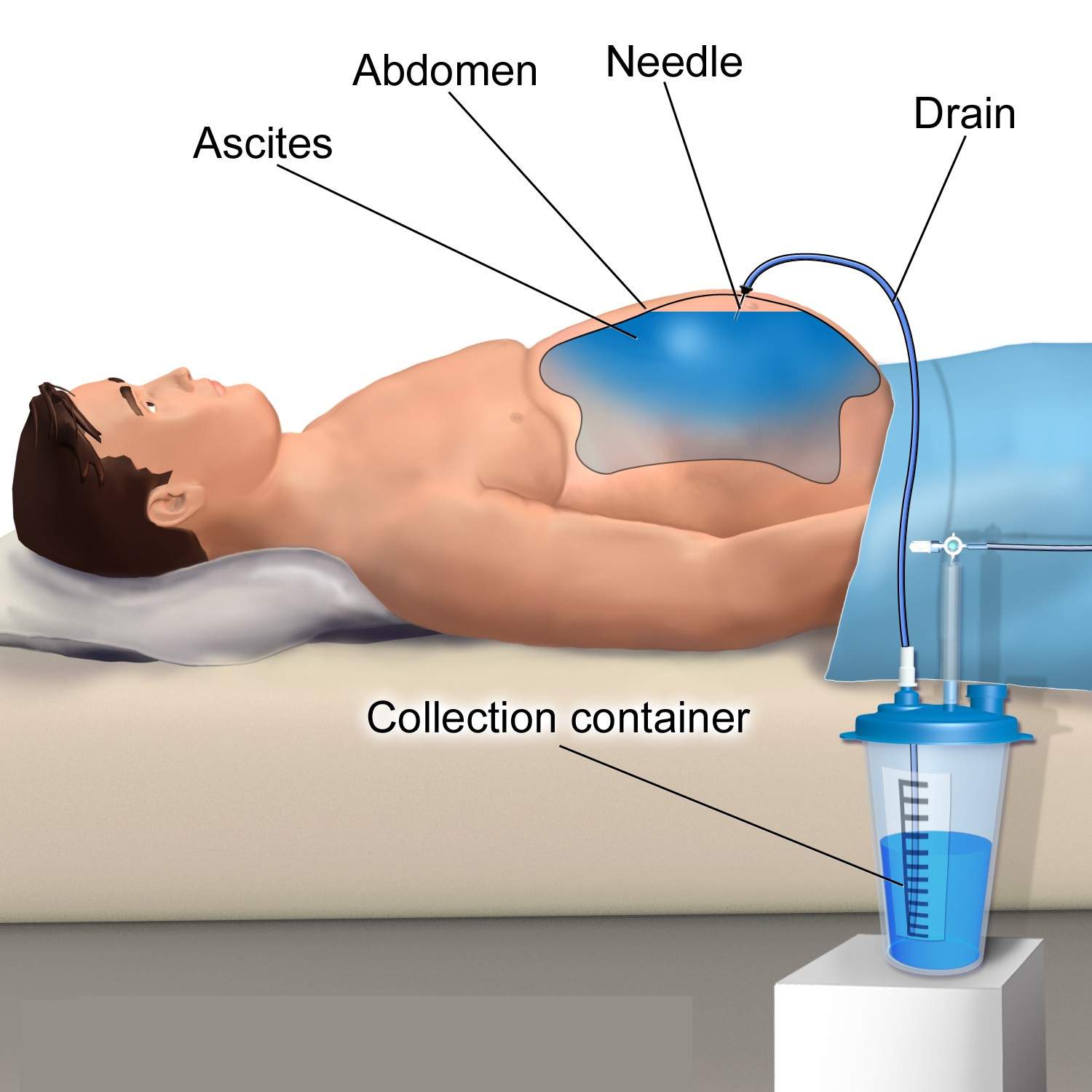 Dr. Vinit Kahalekar Gastroenterologist in Aurangabad